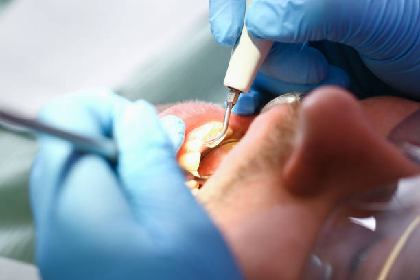 Best Weekend Emergency Dentist in El Cenizo, TX