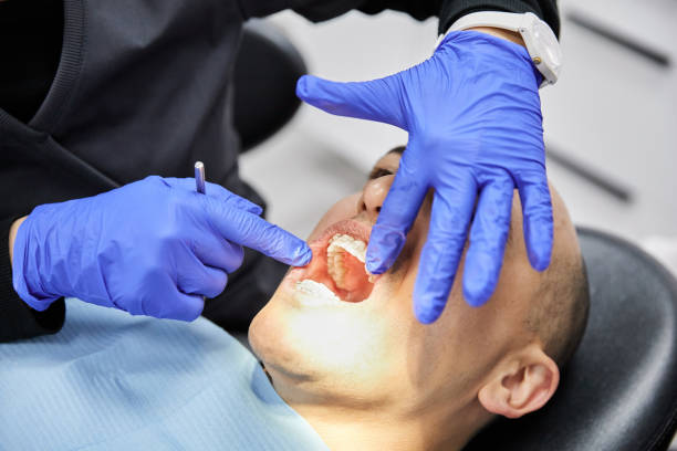 Best Emergency Tooth Extraction in El Cenizo, TX