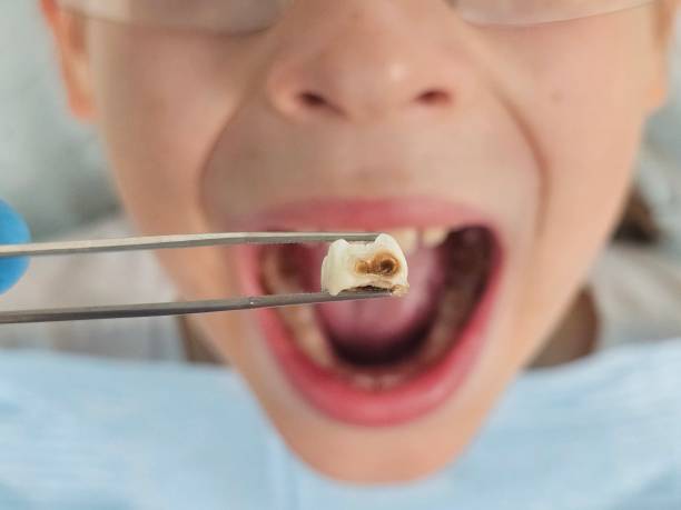 Best Walk-In Emergency Dentist in El Cenizo, TX