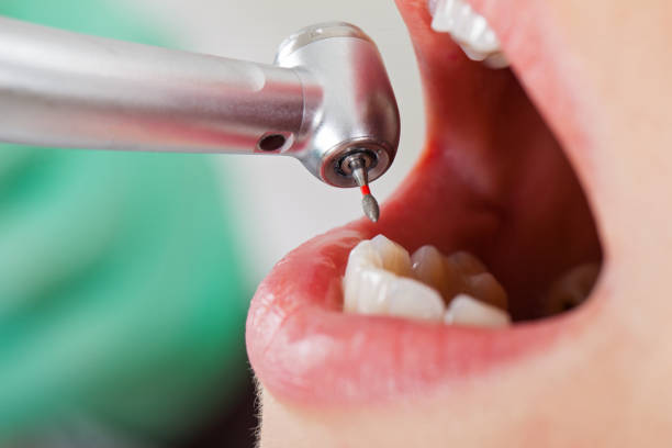 Best Emergency Treatment for Toothache in El Cenizo, TX